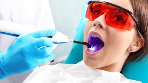 Descubra como funciona o clareamento dental a laser!
