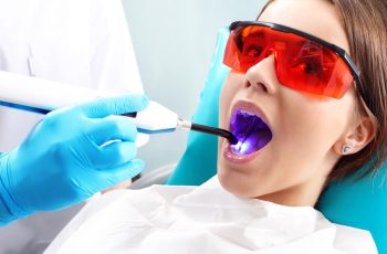 Descubra como funciona o clareamento dental a laser!