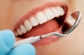 Descubra quais são os principais tratamentos para estética dental